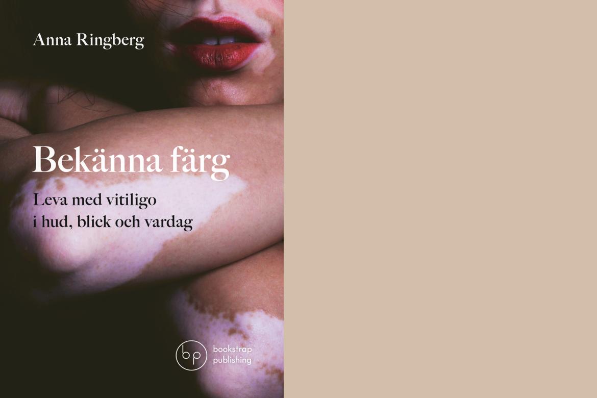 Synliggör en iögonenfallande hudsjukdom